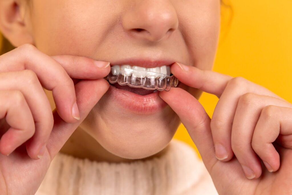 Dentista Infantil en León, Guanajuato: Odontopediatras Recomendados