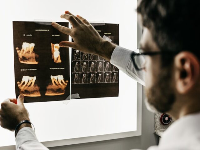 Caries de Biberón en Bebés: Causas, Síntomas y Tratamiento