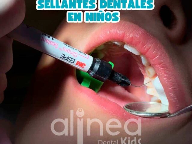 Sellantes Dentales para Niños: Qué Son, Costos y Beneficios 2026