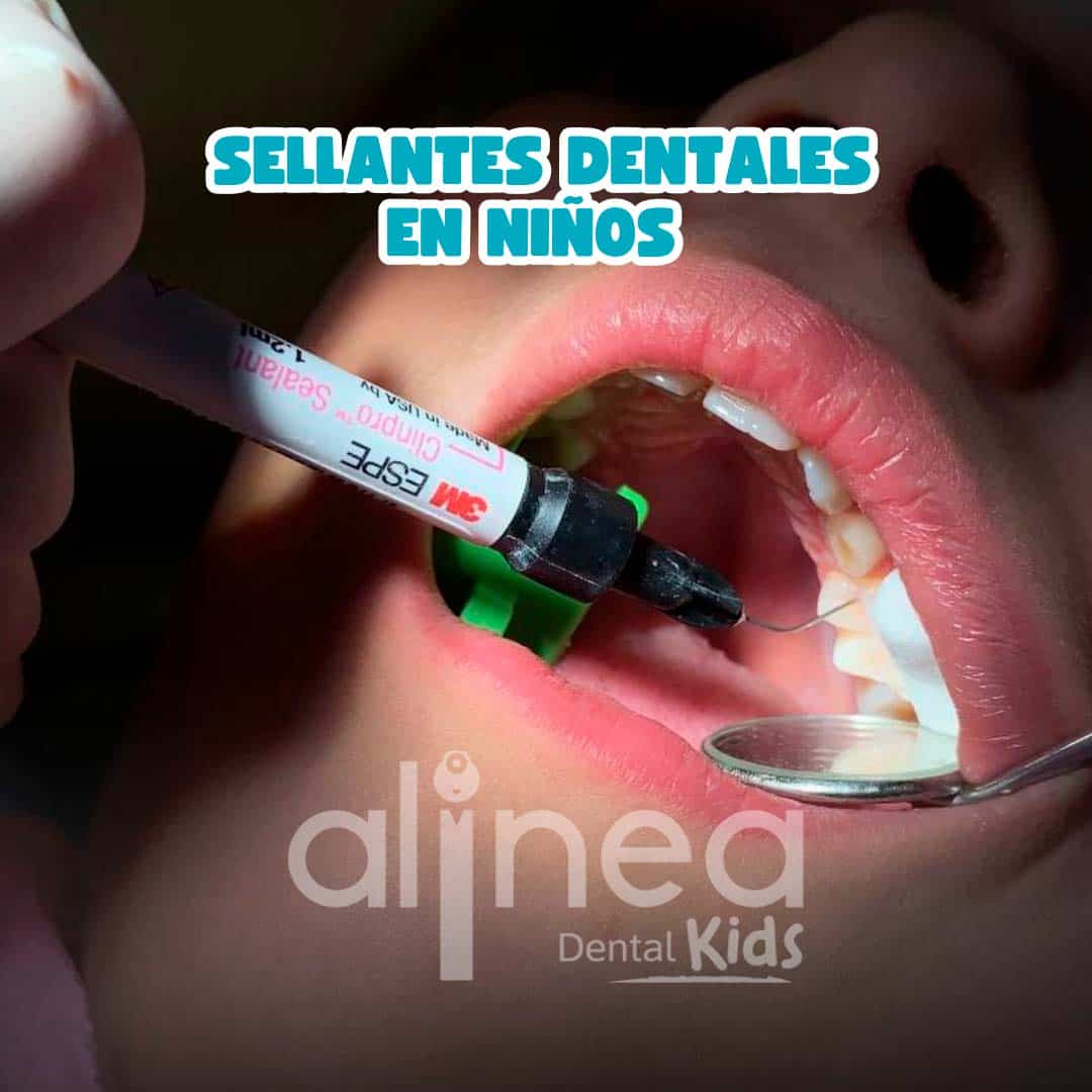 Sellantes Dentales para Niños: Qué Son, Costos y Beneficios 2026